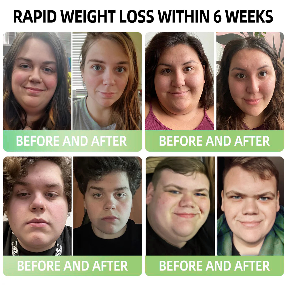 [See results in 7 days]🧑‍⚕️𝐋𝐞𝐫𝐜𝐞𝐚® 𝐆𝐋𝐏-𝟏 𝐌𝐨𝐫𝐢𝐧𝐠𝐚 𝐒𝐥𝐢𝐦𝐦𝐢𝐧𝐠 & 𝐇𝐞𝐚𝐥𝐭𝐡 𝐁𝐨𝐨𝐬𝐭 𝐃𝐫𝐨𝐩𝐬 (𝐅𝐨𝐨𝐝-𝐠𝐫𝐚𝐝𝐞 𝐅𝐚𝐭 𝐁𝐮𝐫𝐧𝐞𝐫)🦁