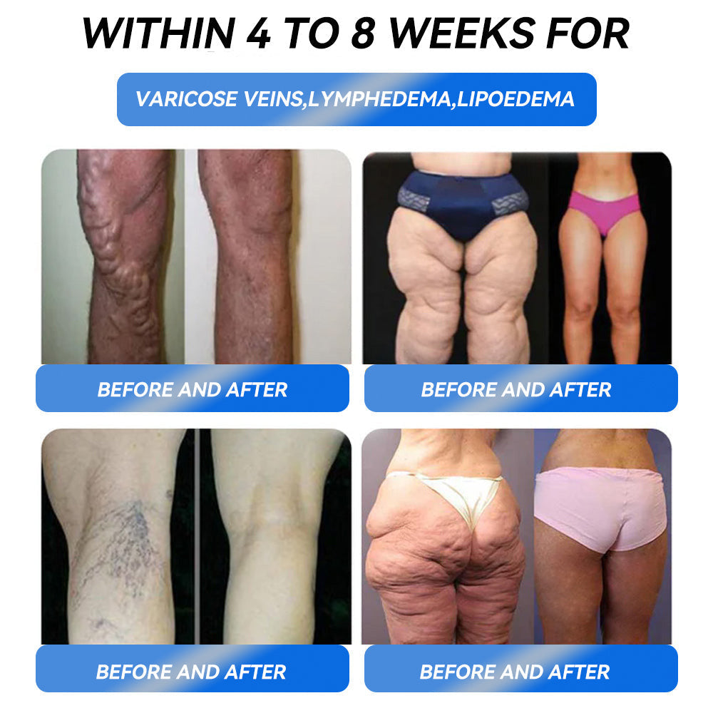TotaI Body HeaIth Start Here✅LERCEA® 𝐆𝐋𝐏-1 𝑃𝑟𝑜 𝑾𝒆𝒊𝐠𝐡𝐭 𝐿𝑜𝒔𝒔 𝐎𝐫𝑎𝑙 𝑺𝒐𝒍𝐮𝐭𝑖𝑜𝑛🌿
