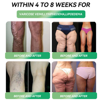 🇦🇺Official Website Direct Sales🥇🥇 𝐋𝙀𝑹𝐂𝗘𝗔® 𝑮𝗟𝐏-𝟏 𝐌𝐞𝐭𝐚𝐛𝐨𝐥𝐢𝐜 𝐁𝐚𝐥𝐚𝐧𝐜𝐞 𝐎𝐫𝐚𝐥 𝐀𝐦𝐩𝐨𝐮𝐥𝐞: 𝐒𝐮𝐢𝐭𝐚𝐛𝐥𝐞 𝐟𝐨𝐫 𝐨𝐛𝐞𝐬𝐢𝐭𝐲, 𝐜𝐚𝐫𝐝𝐢𝐨𝐯𝐚𝐬𝐜𝐮𝐥𝐚𝐫 𝐝𝐢𝐬𝐞𝐚𝐬𝐞, 𝐝𝐢𝐚𝐛𝐞𝐭𝐞𝐬, 𝐬𝐥𝐞𝐞𝐩 𝐚𝐩𝐧𝐞𝐚 𝐬𝐲𝐧𝐝𝐫𝐨𝐦𝐞, 𝐣𝐨𝐢𝐧𝐭 𝐩𝐫𝐨𝐛𝐥𝐞𝐦𝐬, 𝐞𝐭𝐜💕