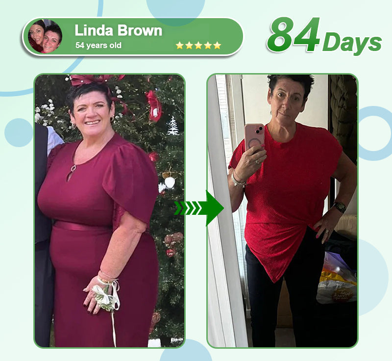 [See results in 7 days]💎𝑳𝒆𝒓𝒄𝒆𝒂® 𝑵𝒂𝒏𝒐 𝑴𝒊𝒄𝒓𝒐𝒏𝒆𝒆𝒅𝒍𝒆 𝑷𝒂𝒕𝒄𝒉 𝒘𝒊𝒕𝒉 𝑺𝑴𝑮𝑻-𝑮𝑳𝑷-1 & 𝑴𝒂𝒕𝒓𝒊𝒙𝒚𝒍 3000（Painless, long-lasting）💚