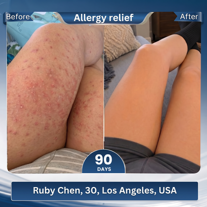 💕Official Store | BLUESHOT®2026  10-in-1 Moringa & Berberine Micro-Particle Sculpting socks|Burn fat, shape, promote blood circulation and metabolism, unclog lymph nodes|See results in 7 days