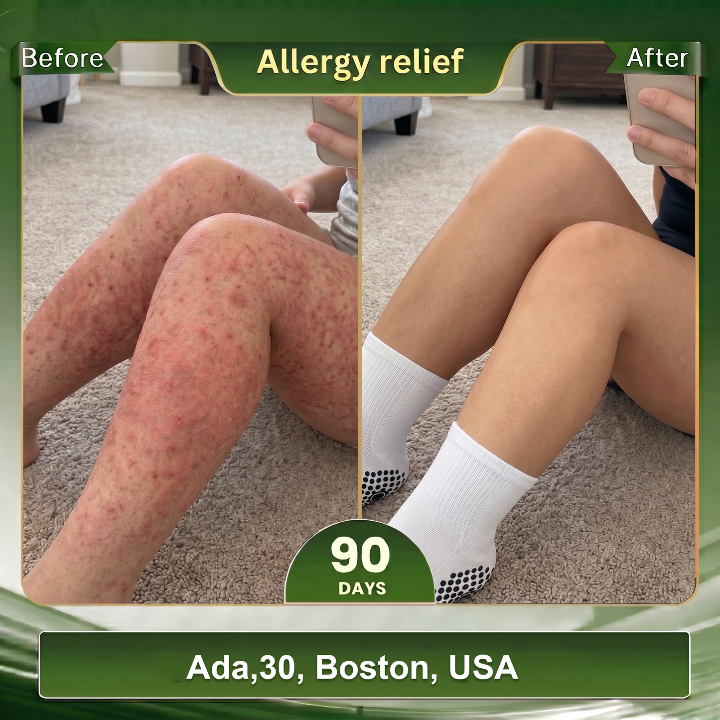💕Official Store |BLUESHOT®2026 10-in-1 Moringa & Berberine Micro-Particle Sculpting socks | Radical Fat-Burn, Varicose Relief & Deep Lymphatic Detox | 7-Day Intensive Sculpting Protocol