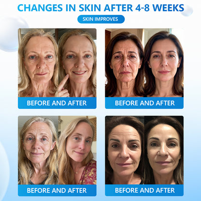 VITALISYS PDRN Anti-age & Firming Serum Natural Ingredients👩‍⚕Maintain Skin Elasticity,May Reduce Wrinkles，Improve Skin Moisture，Maintain Healthy Skin Structure，Multiple Anti-Aging Formulas️