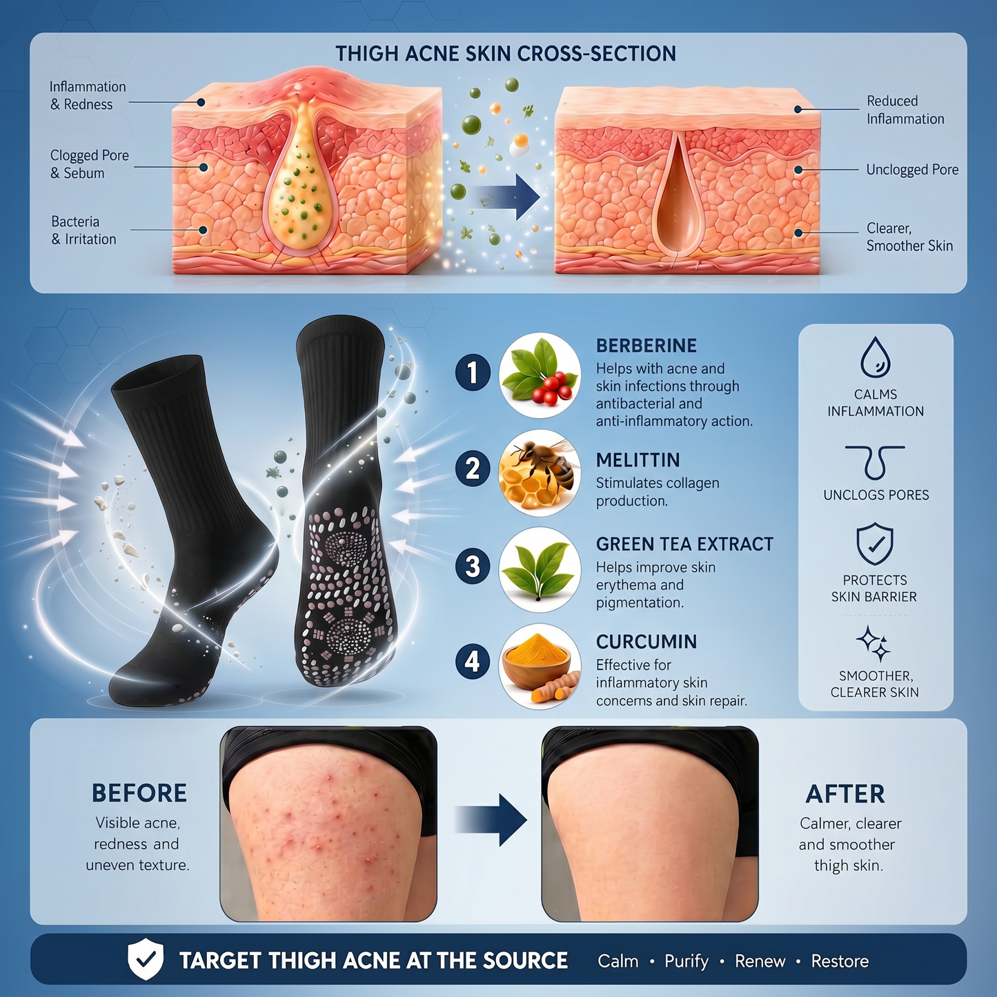 💕Official Store | BLUESHOT®2026  10-in-1 Moringa & Berberine Micro-Particle Sculpting socks|Burn fat, shape, promote blood circulation and metabolism, unclog lymph nodes|See results in 7 days
