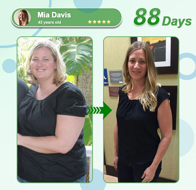 [See results in 7 days]💎𝑳𝒆𝒓𝒄𝒆𝒂® 𝑵𝒂𝒏𝒐 𝑴𝒊𝒄𝒓𝒐𝒏𝒆𝒆𝒅𝒍𝒆 𝑷𝒂𝒕𝒄𝒉 𝒘𝒊𝒕𝒉 𝑺𝑴𝑮𝑻-𝑮𝑳𝑷-1 & 𝑴𝒂𝒕𝒓𝒊𝒙𝒚𝒍 3000（Painless, long-lasting）💚
