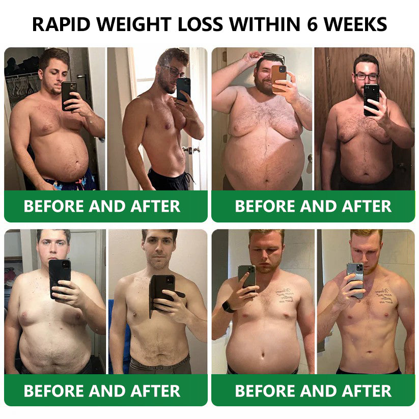 [See results in 7 days]💎𝑳𝒆𝒓𝒄𝒆𝒂® 𝑵𝒂𝒏𝒐 𝑴𝒊𝒄𝒓𝒐𝒏𝒆𝒆𝒅𝒍𝒆 𝑷𝒂𝒕𝒄𝒉 𝒘𝒊𝒕𝒉 𝑺𝑴𝑮𝑻-𝑮𝑳𝑷-1 & 𝑴𝒂𝒕𝒓𝒊𝒙𝒚𝒍 3000（Painless, long-lasting）💚