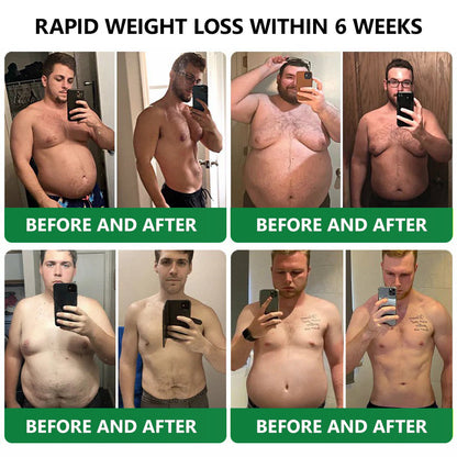 [See results in 7 days]💎𝑳𝒆𝒓𝒄𝒆𝒂® 𝑵𝒂𝒏𝒐 𝑴𝒊𝒄𝒓𝒐𝒏𝒆𝒆𝒅𝒍𝒆 𝑷𝒂𝒕𝒄𝒉 𝒘𝒊𝒕𝒉 𝑺𝑴𝑮𝑻-𝑮𝑳𝑷-1 & 𝑴𝒂𝒕𝒓𝒊𝒙𝒚𝒍 3000（Painless, long-lasting）💚