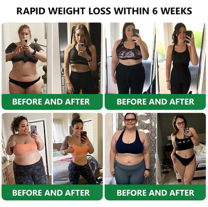 [See results in 7 days]💎𝑳𝒆𝒓𝒄𝒆𝒂® 𝑵𝒂𝒏𝒐 𝑴𝒊𝒄𝒓𝒐𝒏𝒆𝒆𝒅𝒍𝒆 𝑷𝒂𝒕𝒄𝒉 𝒘𝒊𝒕𝒉 𝑺𝑴𝑮𝑻-𝑮𝑳𝑷-1 & 𝑴𝒂𝒕𝒓𝒊𝒙𝒚𝒍 3000（Painless, long-lasting）💚