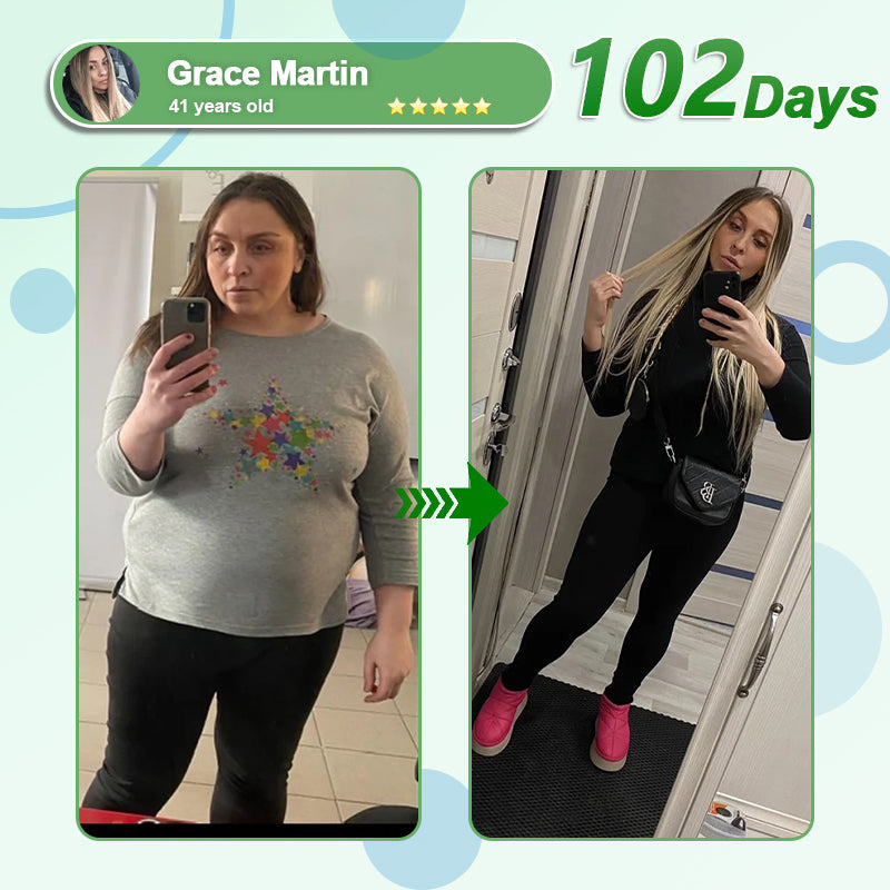 [See results in 7 days]💎𝑳𝒆𝒓𝒄𝒆𝒂® 𝑵𝒂𝒏𝒐 𝑴𝒊𝒄𝒓𝒐𝒏𝒆𝒆𝒅𝒍𝒆 𝑷𝒂𝒕𝒄𝒉 𝒘𝒊𝒕𝒉 𝑺𝑴𝑮𝑻-𝑮𝑳𝑷-1 & 𝑴𝒂𝒕𝒓𝒊𝒙𝒚𝒍 3000（Painless, long-lasting）💚