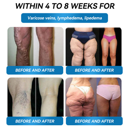 𝐎𝐟𝐟𝐢𝐜𝐢𝐚𝐥 𝐔𝐊 𝐂𝐞𝐫𝐭𝐢𝐟𝐢𝐞𝐝👨‍⚕️ 𝐅𝐥𝐚𝐠𝐬𝐡𝐢𝐩 𝐒𝐭𝐨𝐫𝐞 𝐃𝐢𝐫𝐞𝐜𝐭 𝐒𝐚𝐥𝐞𝐬|✅ 𝘓𝘌𝘙𝘊𝘌𝘈® 𝐆𝗟𝐏-𝟏 𝑴𝒆𝒕𝒂𝒃𝒐𝒍𝒊𝒄 𝑩𝒂𝒍𝒂𝒏𝒄𝒆 𝑶𝒓𝒂𝒍 𝑨𝒎𝒑𝒐𝒖𝒍𝒆𝒔: 𝐒𝐮𝐢𝐭𝐚𝐛𝐥𝐞 𝐟𝐨𝐫 𝐨𝐛𝐞𝐬𝐢𝐭𝐲, 𝐜𝐚𝐫𝐝𝐢𝐨𝐯𝐚𝐬𝐜𝐮𝐥𝐚𝐫 𝐝𝐢𝐬𝐞𝐚𝐬𝐞𝐬, 𝐝𝐢𝐚𝐛𝐞𝐭𝐞𝐬, 𝐬𝐥𝐞𝐞𝐩 𝐚𝐩𝐧𝐞𝐚 𝐬𝐲𝐧𝐝𝐫𝐨𝐦𝐞, 𝐣𝐨𝐢𝐧𝐭 𝐢𝐬𝐬𝐮𝐞𝐬, 𝐚𝐧𝐝 𝐦𝐨𝐫𝐞 🎁