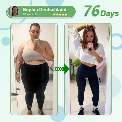 [See results in 7 days]💎𝑳𝒆𝒓𝒄𝒆𝒂® 𝑵𝒂𝒏𝒐 𝑴𝒊𝒄𝒓𝒐𝒏𝒆𝒆𝒅𝒍𝒆 𝑷𝒂𝒕𝒄𝒉 𝒘𝒊𝒕𝒉 𝑺𝑴𝑮𝑻-𝑮𝑳𝑷-1 & 𝑴𝒂𝒕𝒓𝒊𝒙𝒚𝒍 3000（Painless, long-lasting）💚