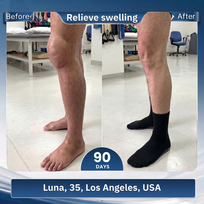 💕Official Store | BLUESHOT®2026  10-in-1 Moringa & Berberine Micro-Particle Sculpting socks|Burn fat, shape, promote blood circulation and metabolism, unclog lymph nodes|See results in 7 days