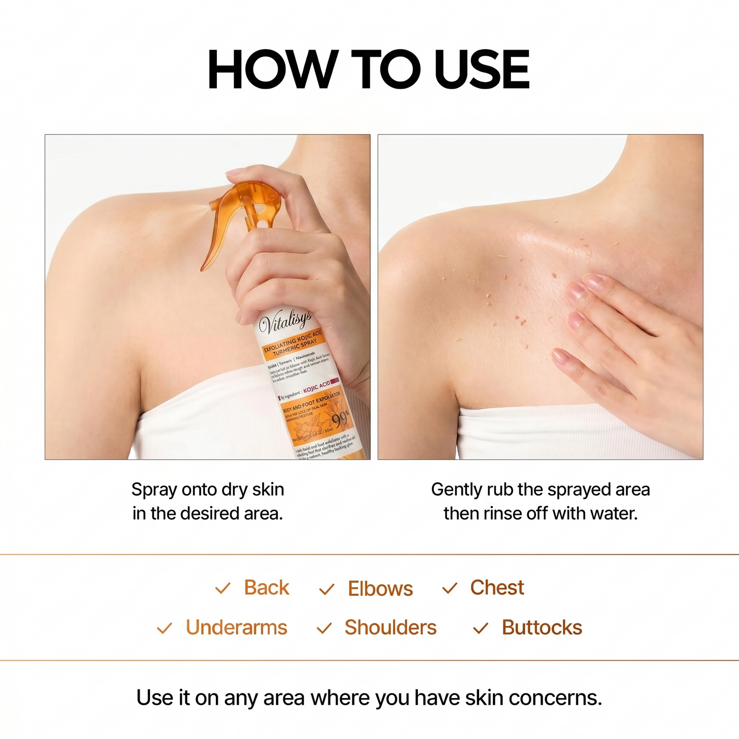 ✅Official Store | 𝓥𝒊𝒕𝙖𝙡𝒊𝙨𝙮𝙨 Keratin Care Kojic Acid Turmeric spray | Mild exfoliation spray, making the skin smoother, brighter and whiter | Suitable for all skin types of keratin care