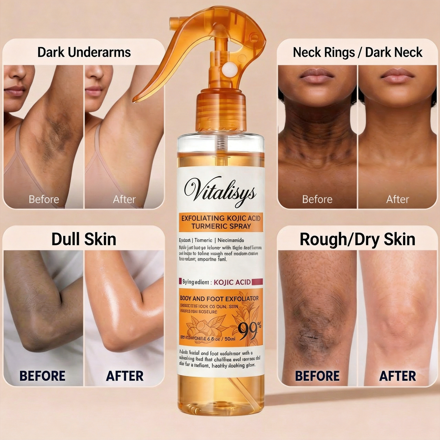 ✅Official Store | 𝓥𝒊𝒕𝙖𝙡𝒊𝙨𝙮𝙨 Keratin Care Kojic Acid Turmeric spray | Mild exfoliation spray, making the skin smoother, brighter and whiter | Suitable for all skin types of keratin care